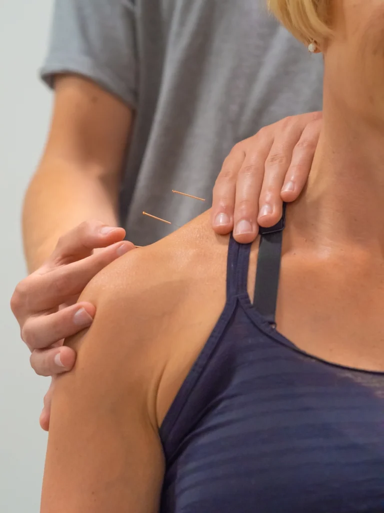 Nick acupuncture shoot 3